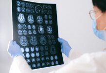 Un vaccino contro la demenza? alzheimer e demenze