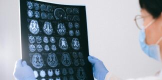Un vaccino contro la demenza? alzheimer e demenze
